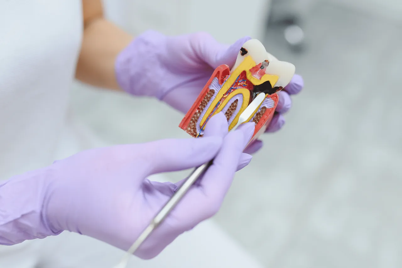endodoncia dental