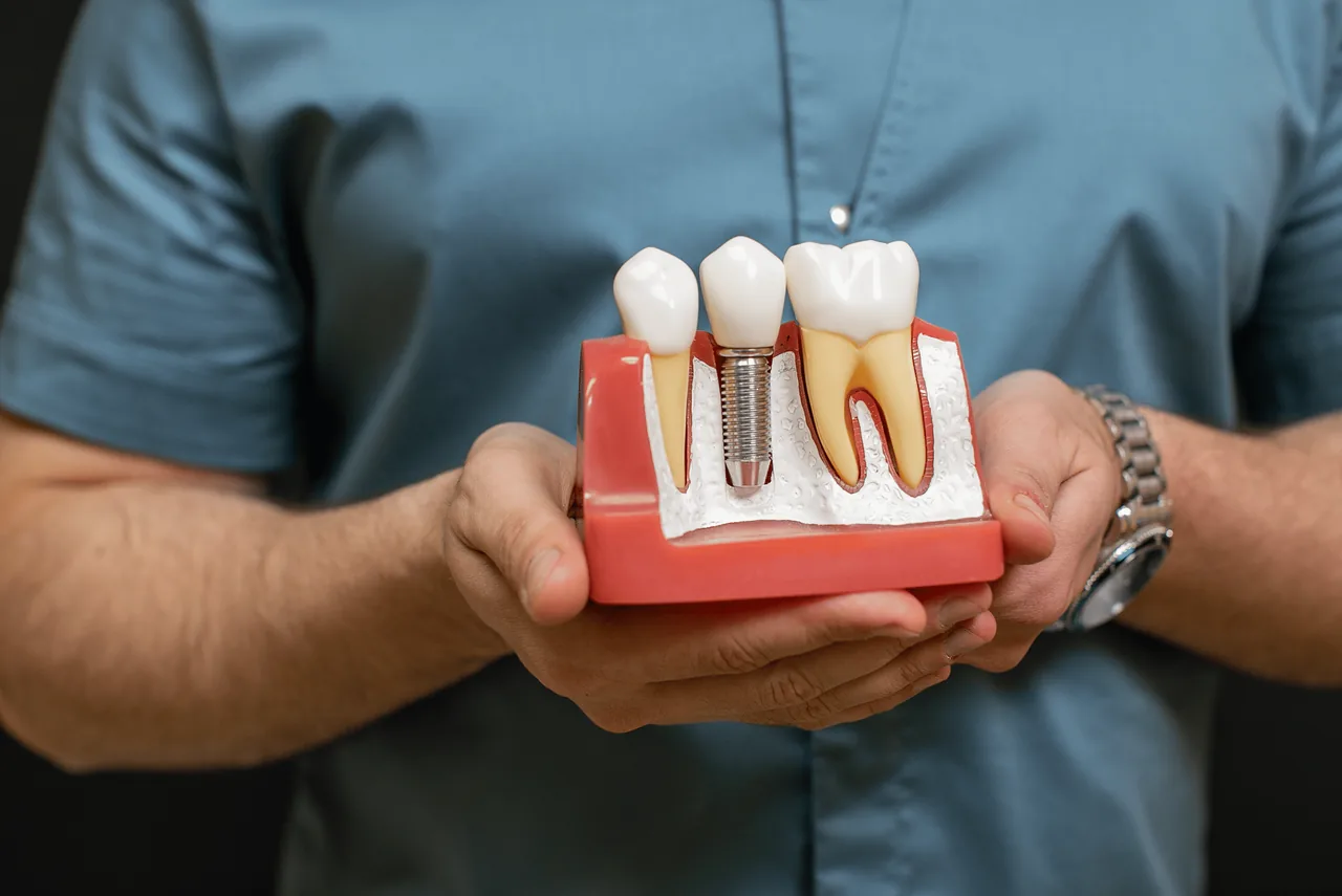 implantes dentales madrid