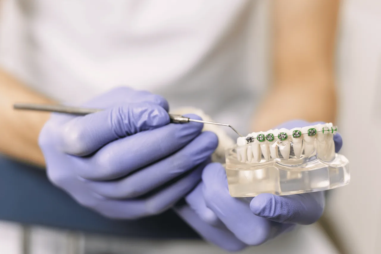 ortodoncia brackets