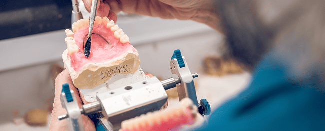 protesis dental madrid