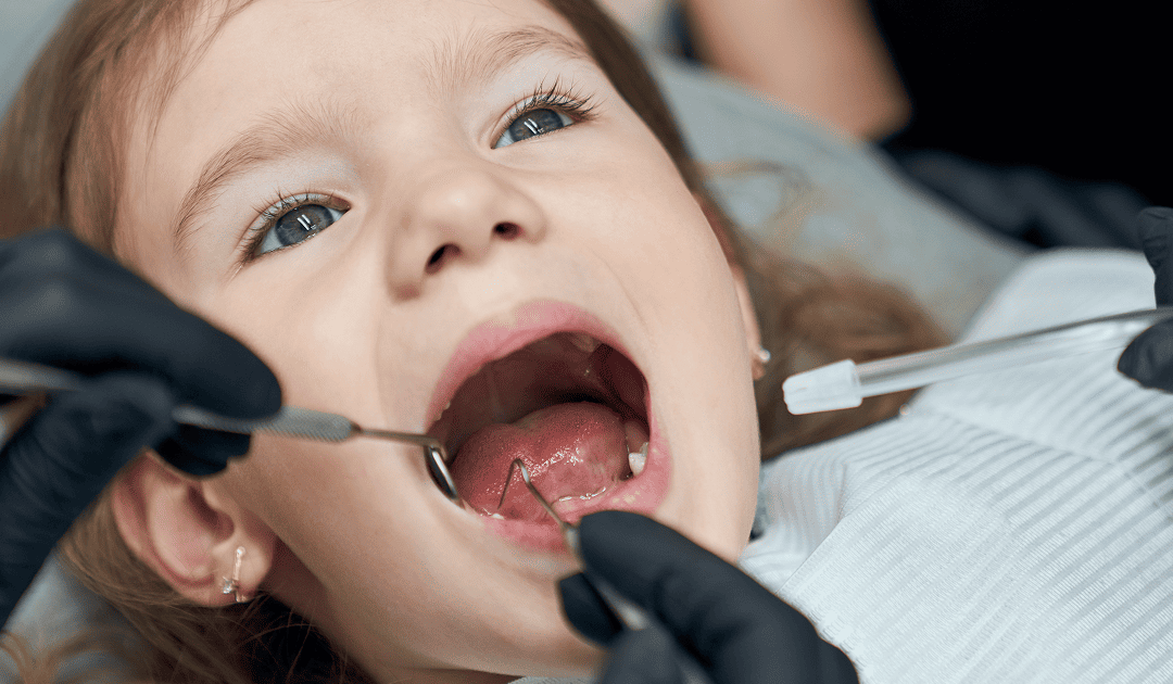 Pulpotomía en niños