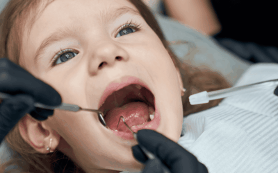 Pulpotomía en niños